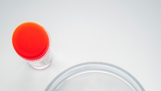 What’s Inside the S&P Biotechnology Select Industry Index?